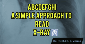 Read more about the article Quick tips to Interpret X ray chest  PA view
