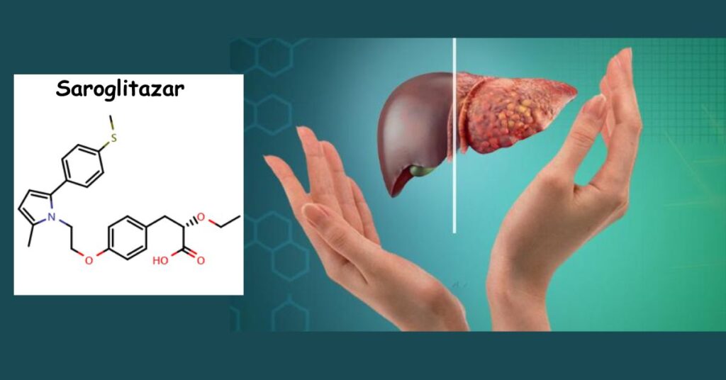 Saroglitazar beside fatty liver